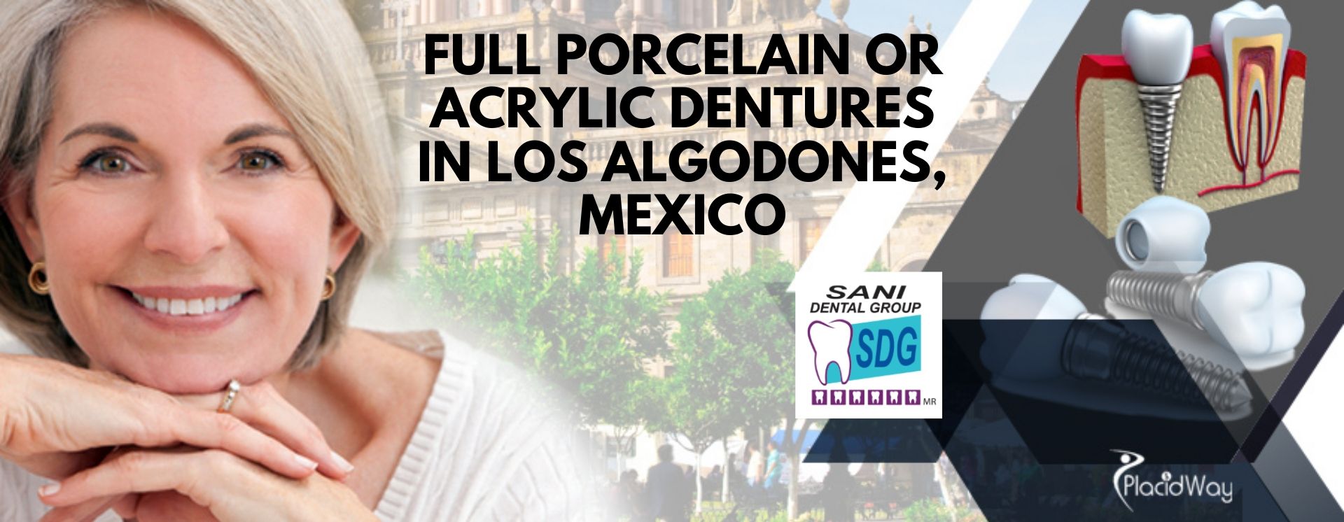 Full Porcelain or Acrylic Dentures Package in L.A. Mexico